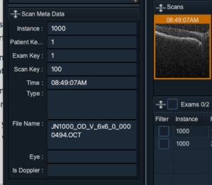 scan metadata